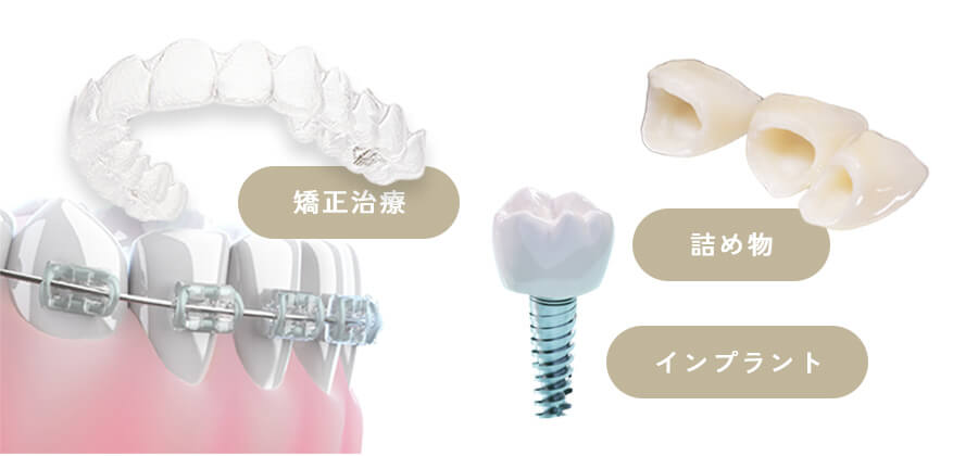 サンプル